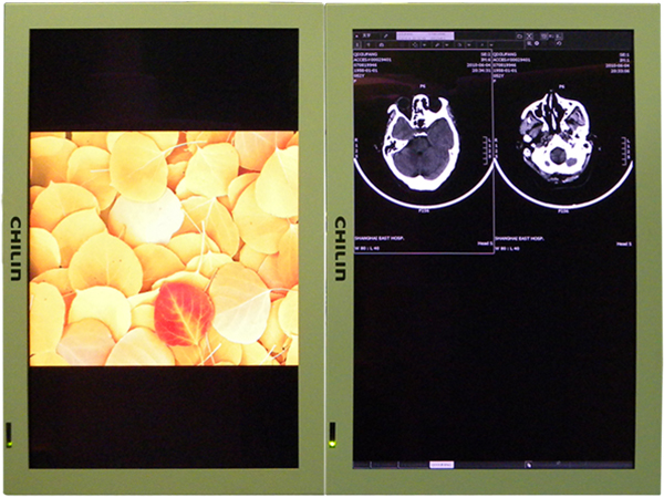上海東方醫 院手術室采用睿觀博光傳