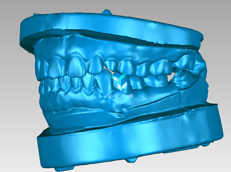 3D掃描牙模/3D掃描醫(yī)學模型/3D定制醫(yī)學模型