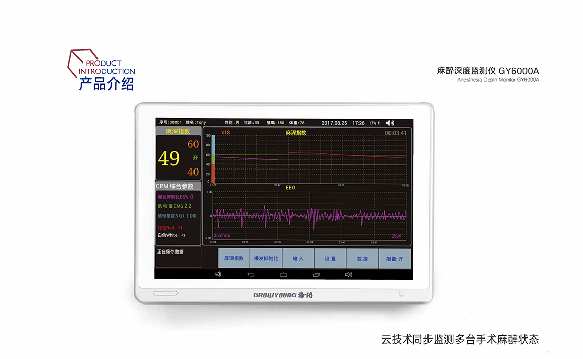麻醉深度監(jiān)測儀