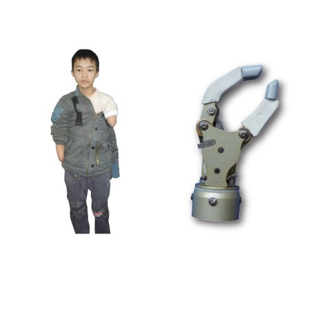 自由度小孩假手(有腕部被動旋轉器)