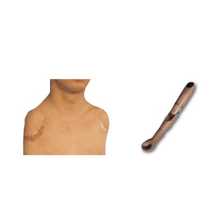 八自由度科生仿生全臂假肢