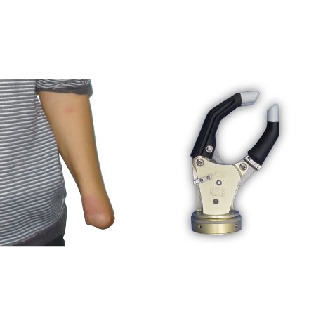 具有被動(dòng)腕的腕離斷-自由度假手