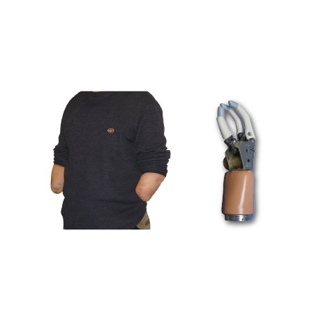 扁腕-自由度假手