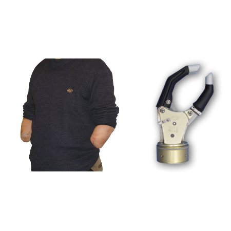 前臂假肢-自由度假手