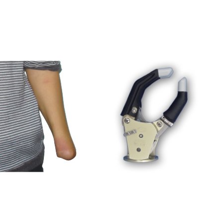 腕離斷-自由度假手