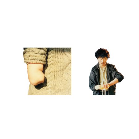 特短前臂殘肢使用的肌電臂