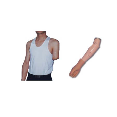 上臂假肢-二自由度假臂（正裝型）