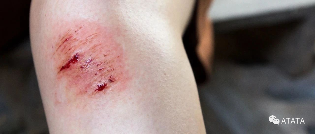 醫(yī)用酒精、紫藥水、雙氧水、碘伏、生理鹽水、ATATA