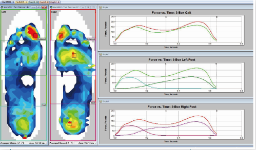Tekscan F-Scan 鞋墊式足底壓力分布測(cè)試系統(tǒng)