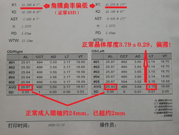 小心，隱藏性近視“害死人”！.png
