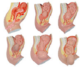 gao級足月胎兒分娩過程模型（6部件）