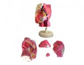 髖部局解模型（4部件）