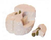 大腦側腦室模型