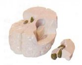 大腦側腦室模型