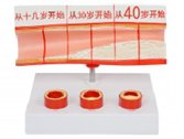 血脂膽固醇+年齡模型