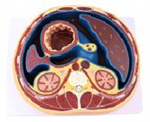 腹腔橫斷模型（帶數(shù)字標識）