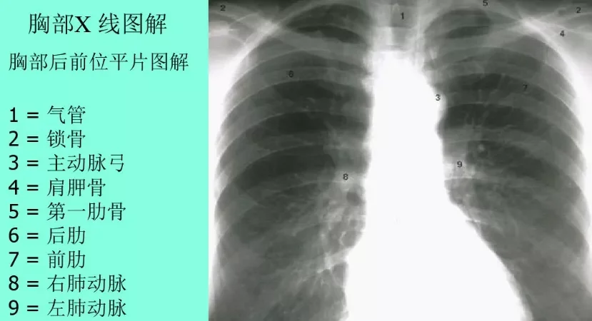648.webp