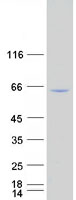 NF-kB p65 (RELA) (NM_021975) 人重組蛋白