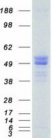 HTRA1 (NM_002775) 人重組蛋白