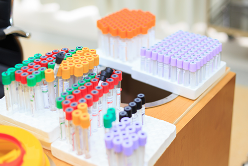 什么是試劑？試劑怎么分類？