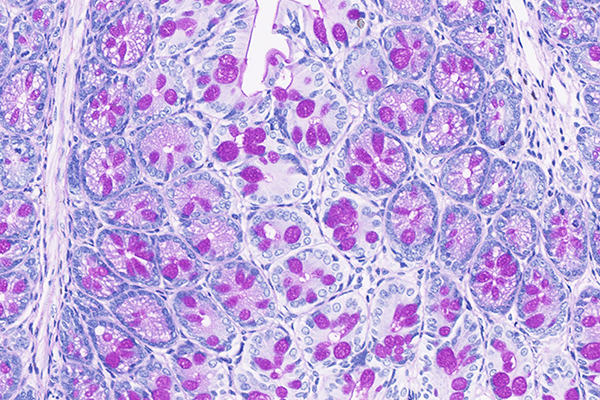 常用的染色方法有哪些呢？