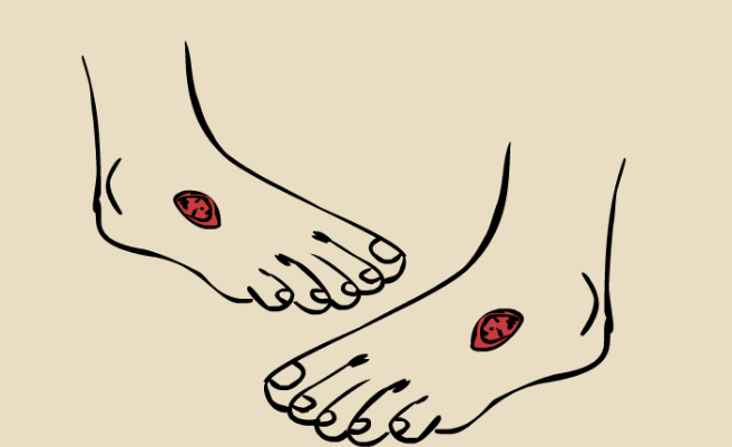 med压力怎么弄如何通过足底压力分布测试系统发现早期糖尿病足？_https://www.jmylbn.com_新闻资讯_第1张