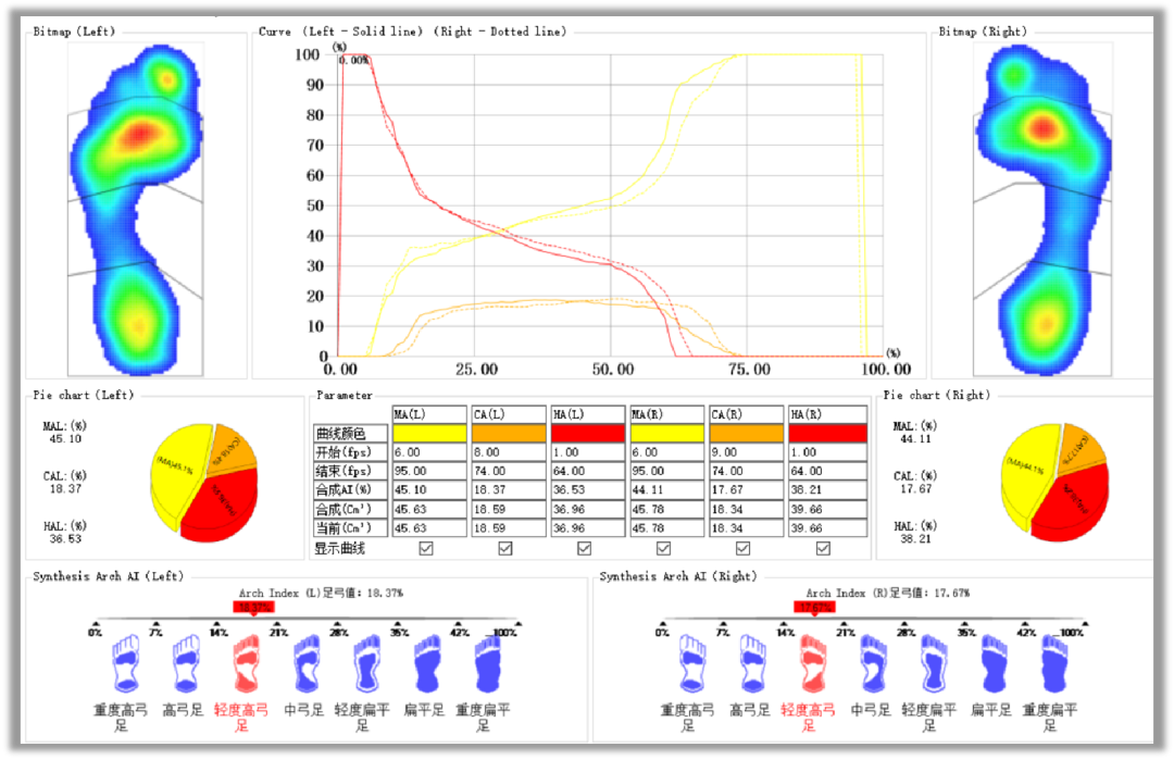med压力怎么弄如何通过足底压力分布测试系统发现早期糖尿病足？_https://www.jmylbn.com_新闻资讯_第4张