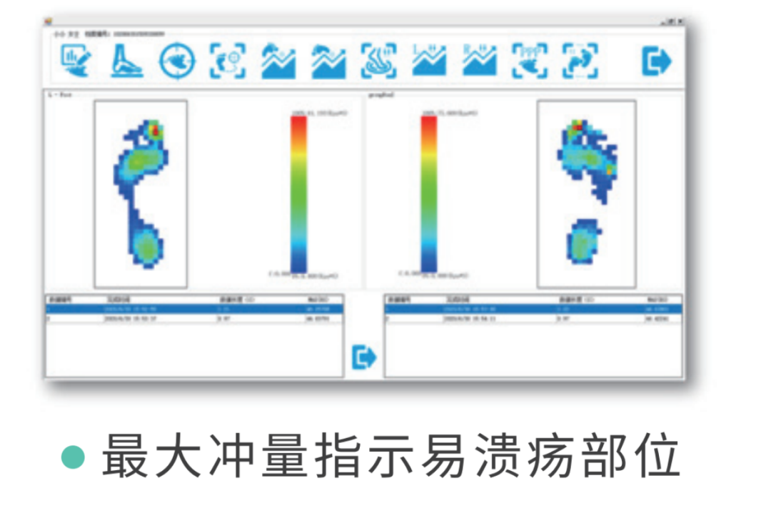med压力怎么弄如何通过足底压力分布测试系统发现早期糖尿病足？_https://www.jmylbn.com_新闻资讯_第3张