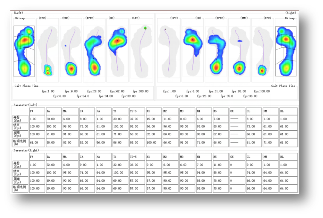 med压力怎么弄如何通过足底压力分布测试系统发现早期糖尿病足？_https://www.jmylbn.com_新闻资讯_第5张