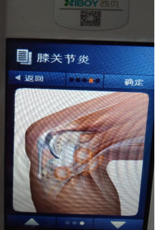 膝關(guān)節(jié)炎.png