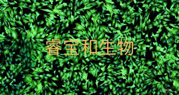 FITC-鬼筆環(huán)肽檢測(cè)試劑盒