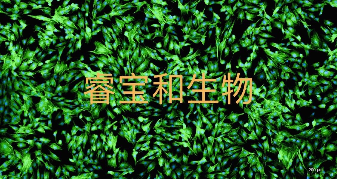 FITC-鬼筆環(huán)肽檢測(cè)試劑盒