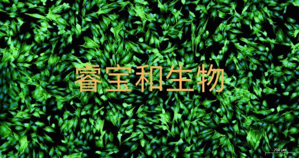 FITC-鬼筆環(huán)肽檢測(cè)試劑盒
