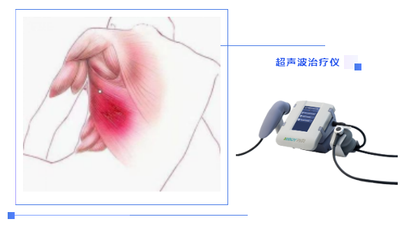 超聲波在軟組織損傷的臨床應(yīng)用1.png
