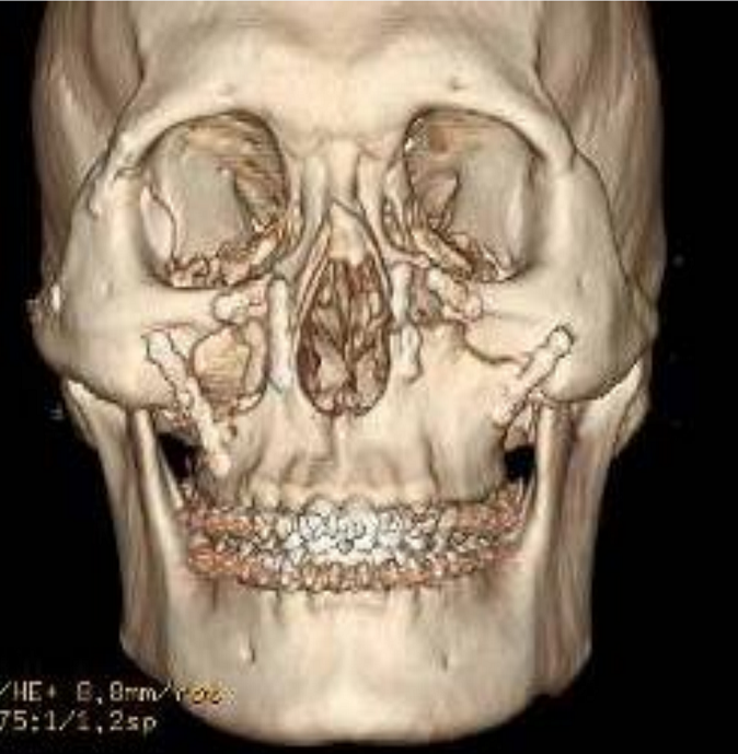 鈦及鈦合金 面中部2.png
