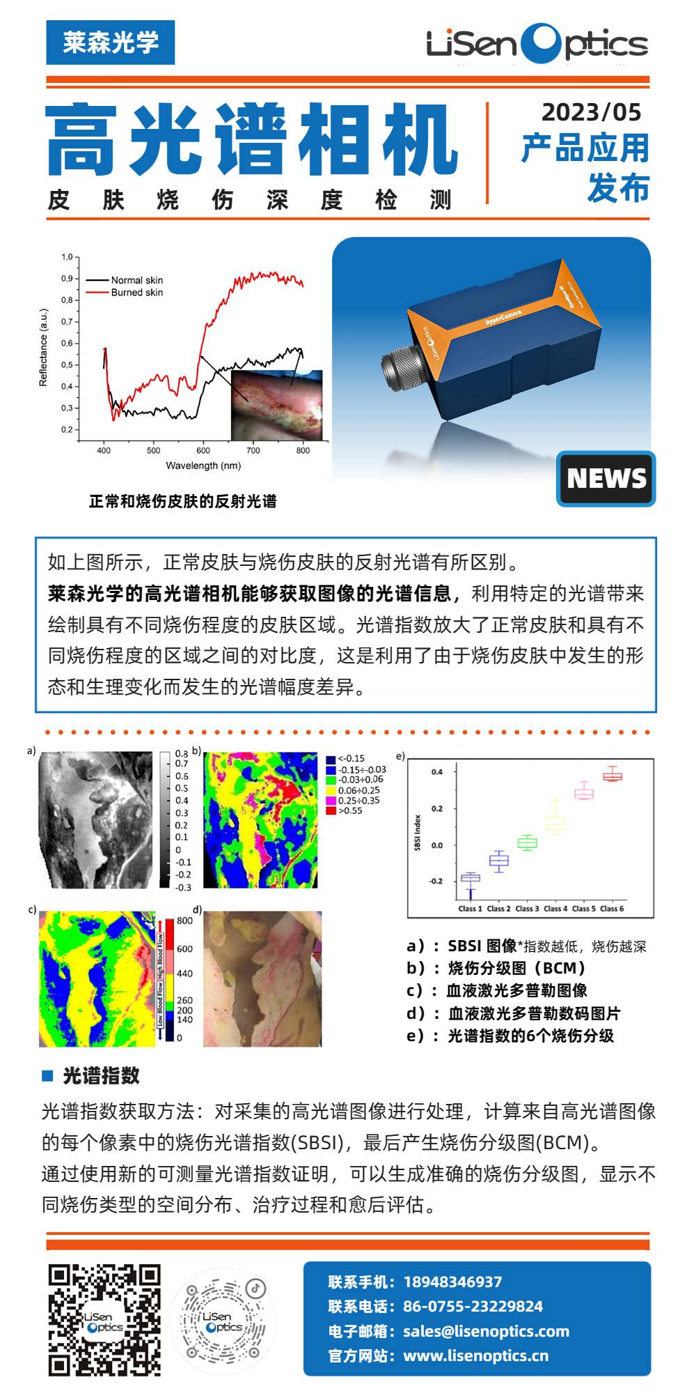 高光譜相機(jī)在皮膚燒傷的深度檢測.jpg