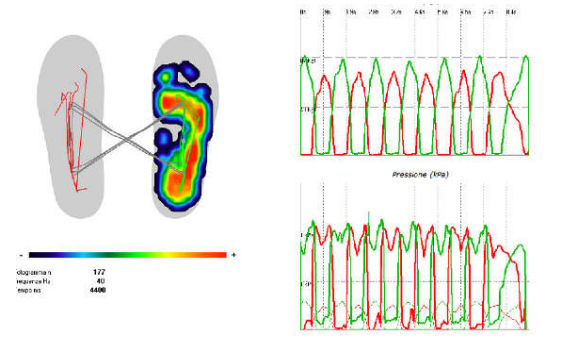 Sensor Medica 足底壓力分析系統(tǒng)