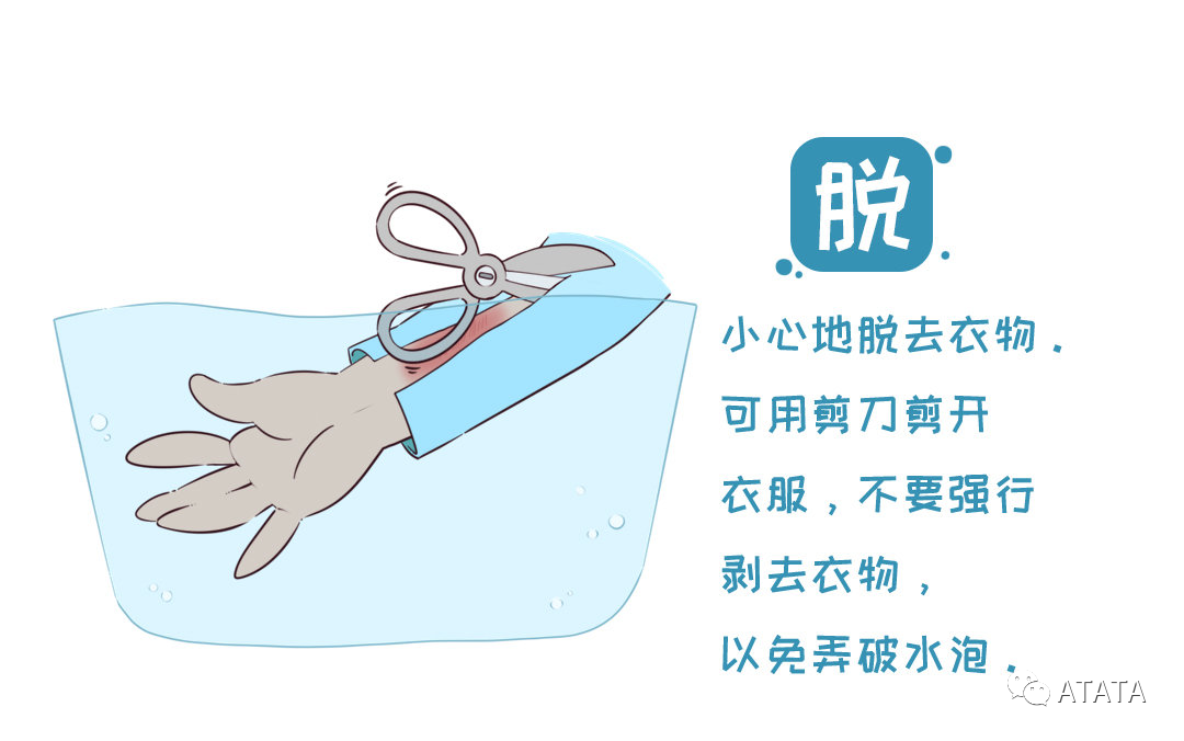 这四类烧伤如何自救?如何在烧伤后进行正确的现场急救?-爱氏(深圳)医药有限公司