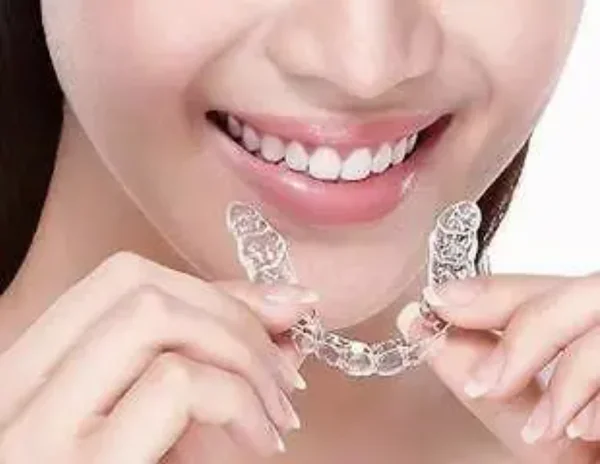 隱適美隱形矯正器
