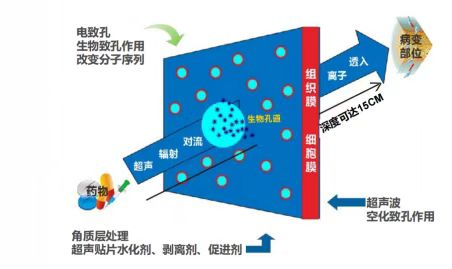 超聲波與痛風(fēng)2.png
