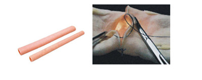 腸管吻合模型.jpg 腸管吻合模型.jpg