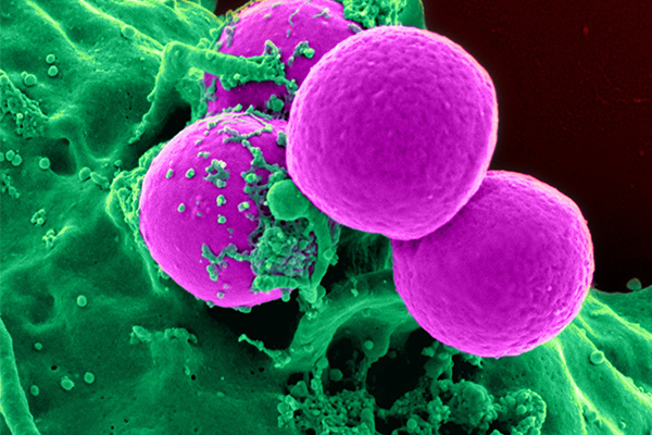 多色免疫熒光技術助力策略優化