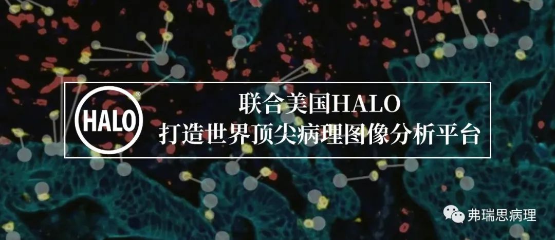 HALO病理圖像分析在免疫病理中的應用