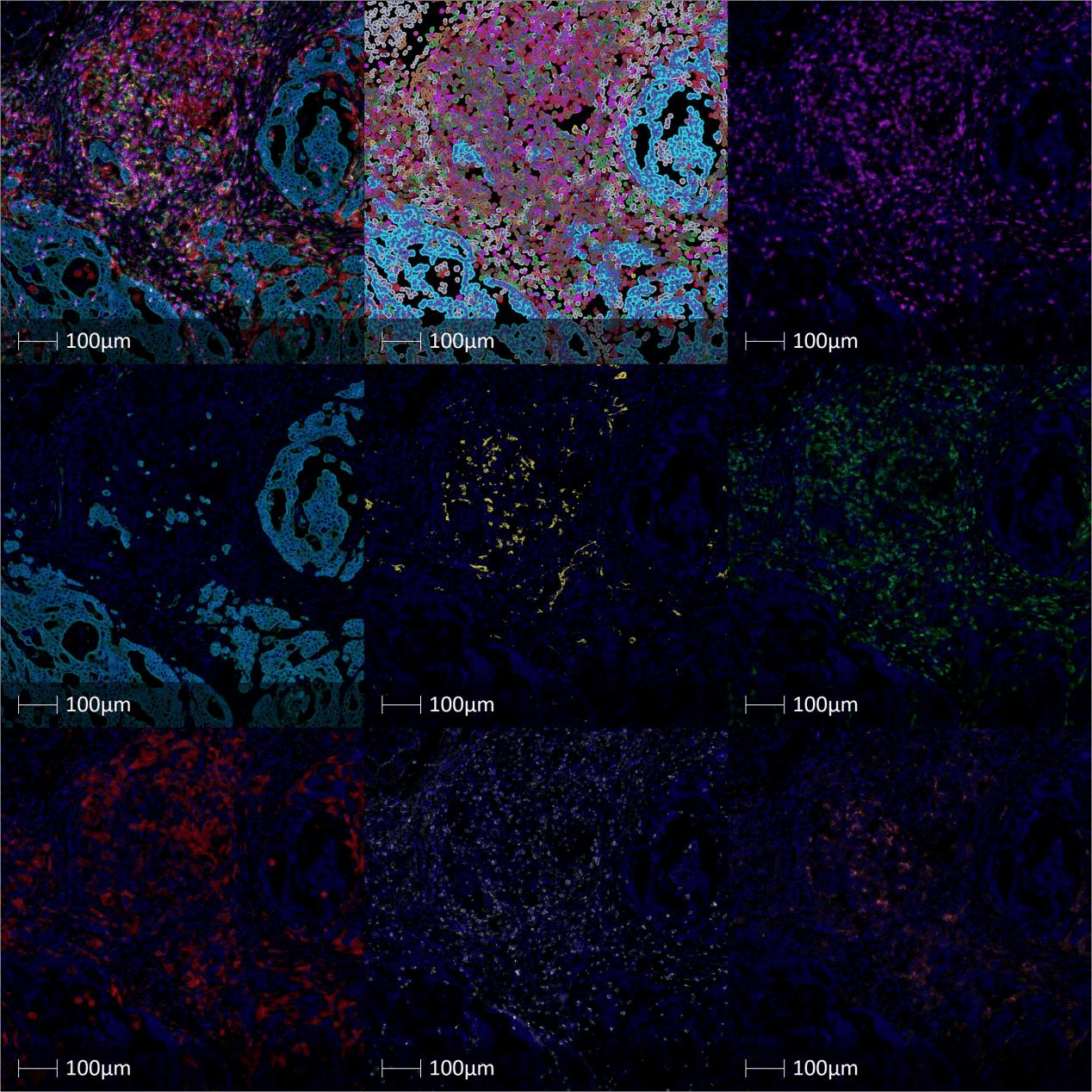 文獻速遞|超多標技術評價分析單個腫瘤細胞的蛋白質組學