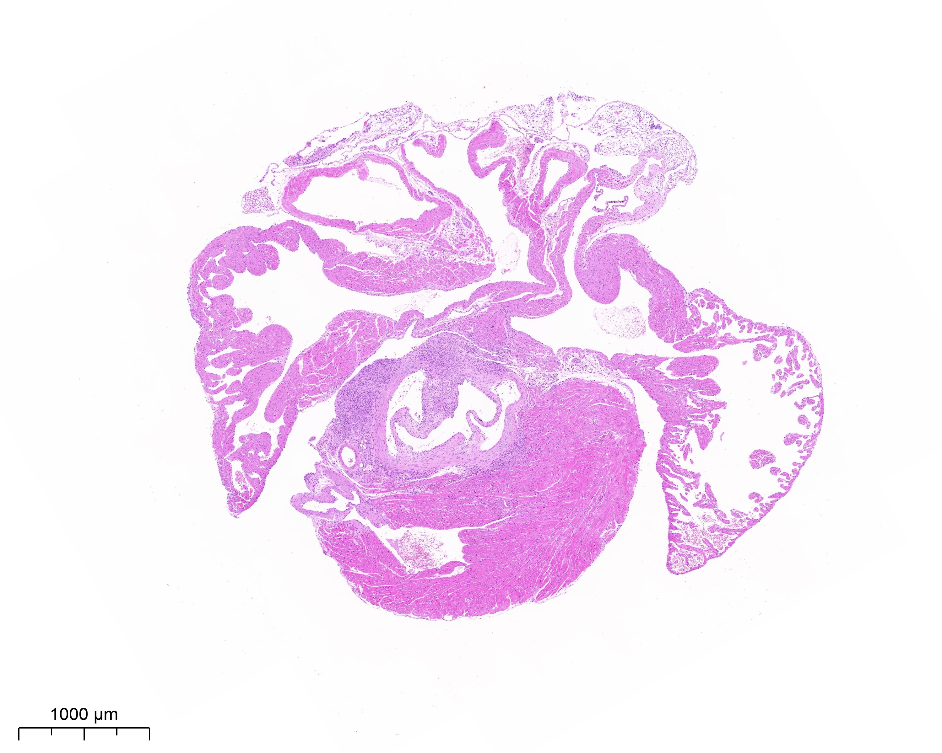 病理人必看！心臟切面制作+染色技術全攻略，告別"心"盲區