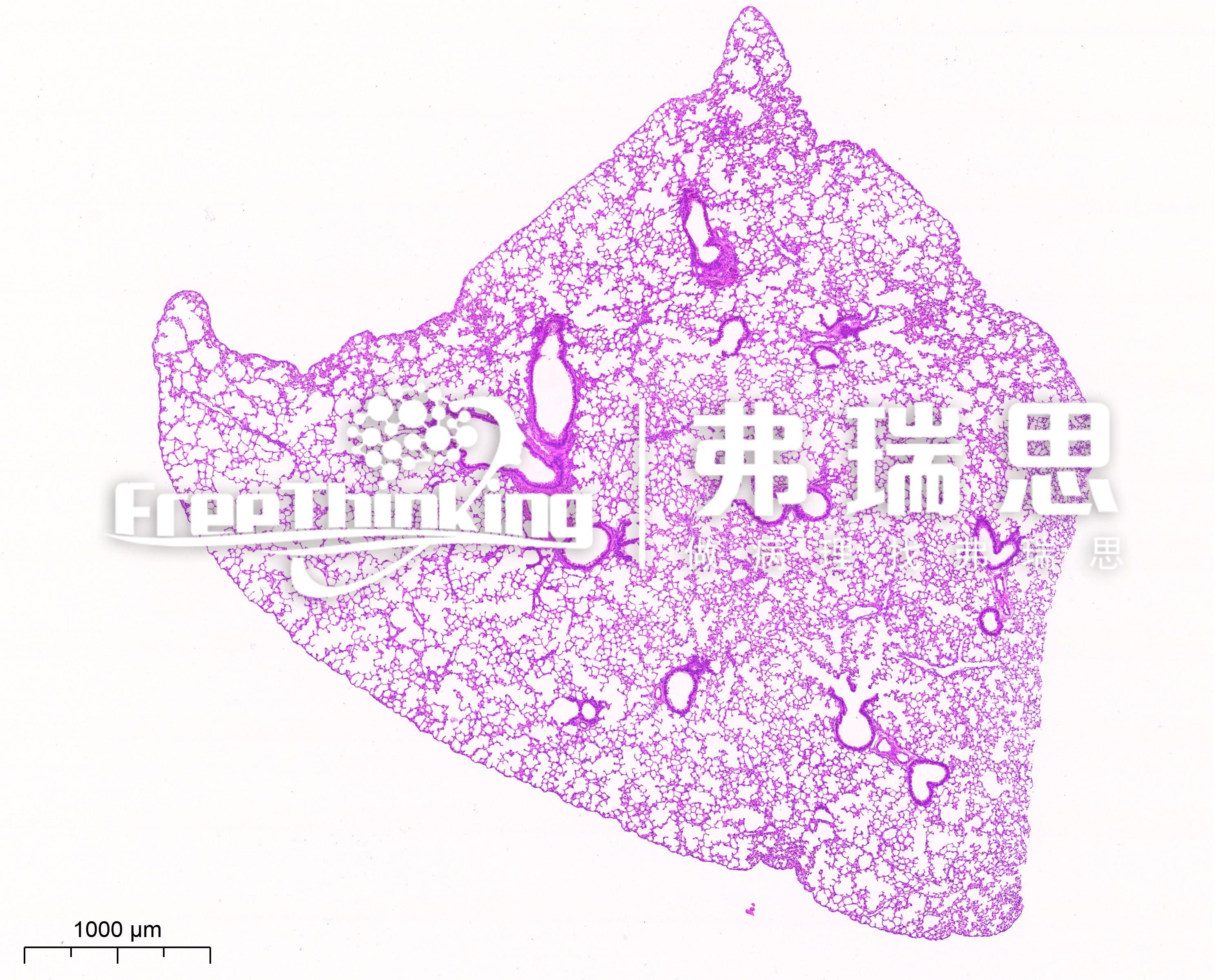 HE染色