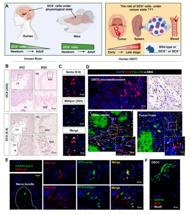 弗瑞思助力 | 南京大學新研究：DCX+細胞如何影響口腔癌免疫治療