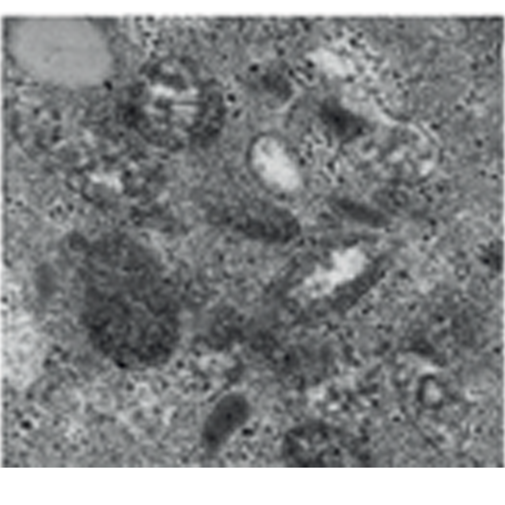 透射电子显微镜技术服务