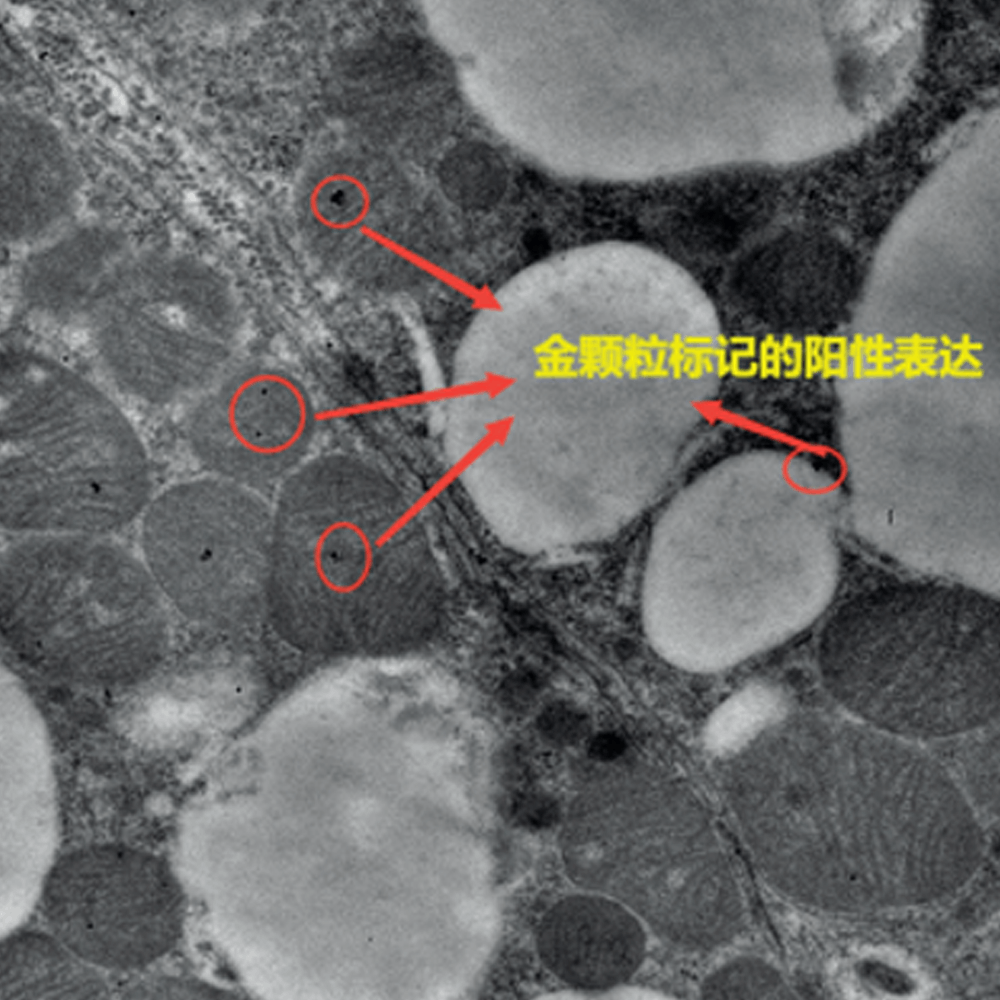 免疫电镜(immunoelectron microscopy)技术