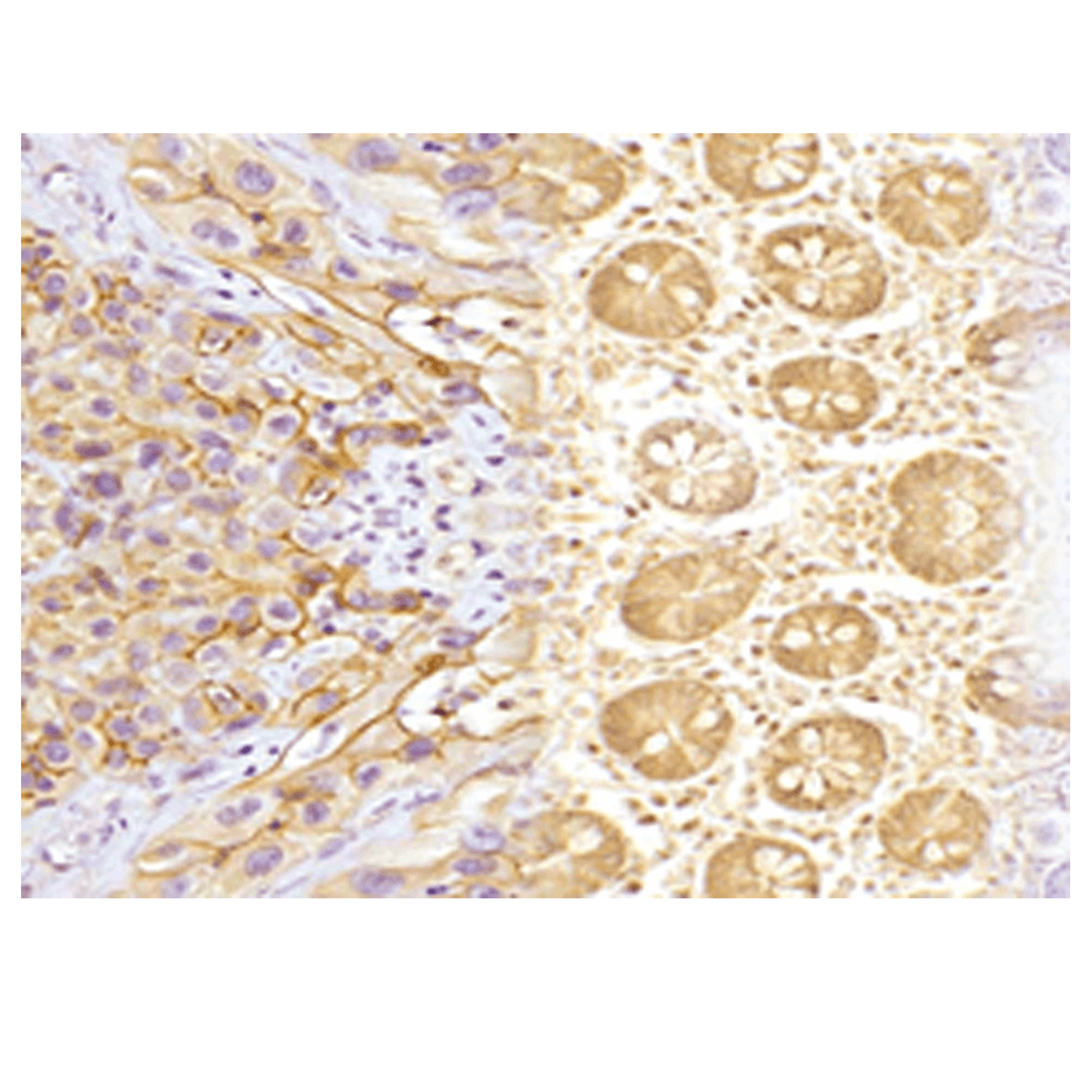 免疫组化（IHC）